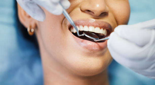 Best Emergency Dental Extractions in River Hills, WI